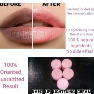 Dark Lip Lightening Cream